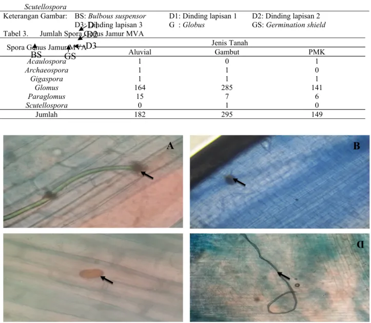 Gambar 2. Hasil pengamatan infeksi jamur MVA pada perbesaran 400X terlihat struktur, (A) Arbuskular, (B) Vesikula, (C) Spora, (D) Hifa.