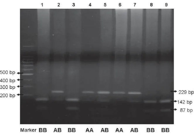 Figure 1. PCR product of 229 bp of TCR-β gene after being run on 1% agarose gel for 60 minutes