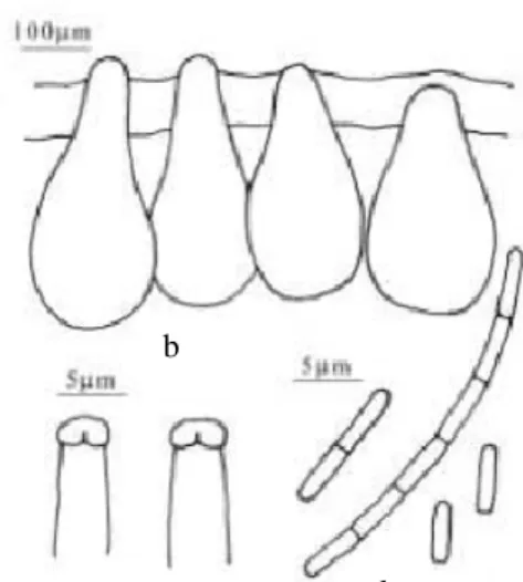 Gambar 8. C. militaris a. stroma, b. perithecia, c. askus, d. askospora. 