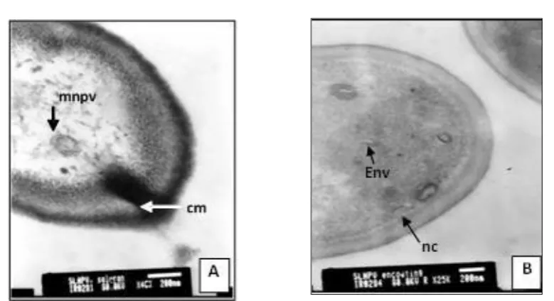 Figure 1. The first phase, the attachment of viruses in the host cell A. The attachment of SpltMNPV at the membrane of suitable host