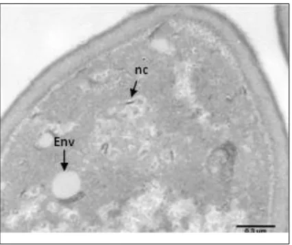 Figure 3. Phase 3, biosynthesis of the virus components (magnification x 5000, bar = 0.3 µm)    Remarks: nc: nucleocapsid, Env: envelope 