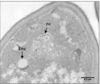 Figure 3. Phase 3, biosynthesis of the virus components (magnification x 5000, bar = 0.3 µm)    Remarks: nc: nucleocapsid, Env: envelope 