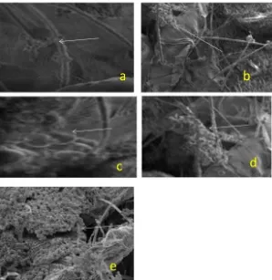 Figure 1. Microphotograph of Metarhizium anisopliae 4 infecting Tetranychus kazawai 4 days after inoculation by Scanning electron microscope micrographs (800 X)
