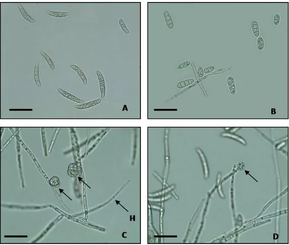 Figure 3.  F. oxysporum spore 