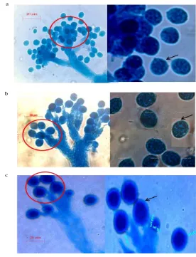 Gambar 5  Persamaan (panah berwarna hitam) dan perbedaan (lingkaran  berwarna merah) morfologi konidia Peronosclerospora sorghi spesimen asal a) Bogor dan b) Malang, dengan P