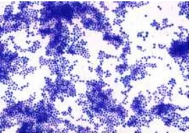 Gambar 1. Gambar mikroskopik ���������������������terlihat bakteri berbentuk bulat/coccus (sumber: Yuwono, 2009) pada pewarnaan Gram, �