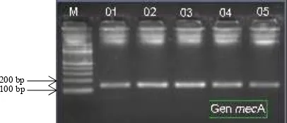 Gambar 3. Amplikon gen mecA hasil PCR dengan berat molekul sekitar 147 bp (sumber: Yuwono, 2009)