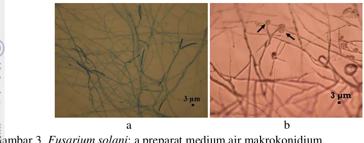 Gambar 4  Fusarium sp. 1: preparat medium air, a makrokonidium,  