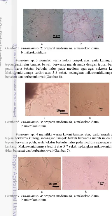 Gambar 5  Fusarium sp. 2: preparat medium air, a makrokonidium, 