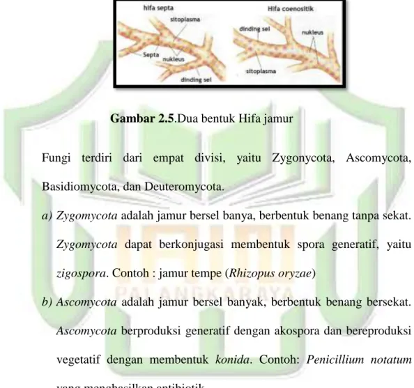 Gambar 2.5.Dua bentuk Hifa jamur 