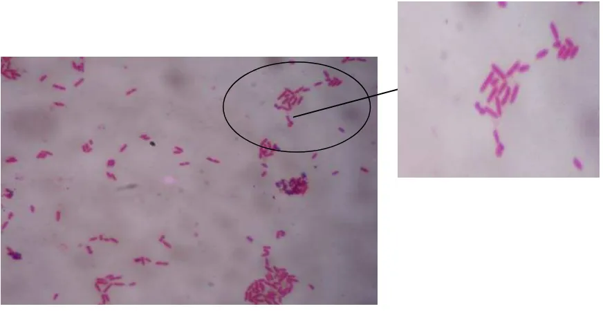 Gambar 11. Bakteri                                  berbentuk batang bewarna merah muda Pseudomonas aeruginosa  bakteri gram negatif  