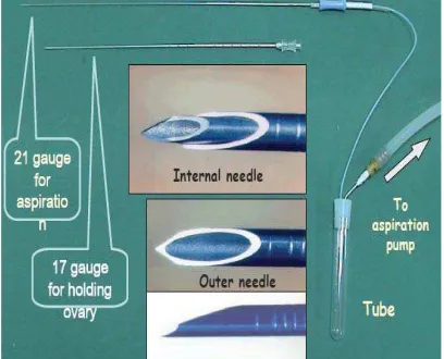 Figure 3. clockwise OPU to Ovary15