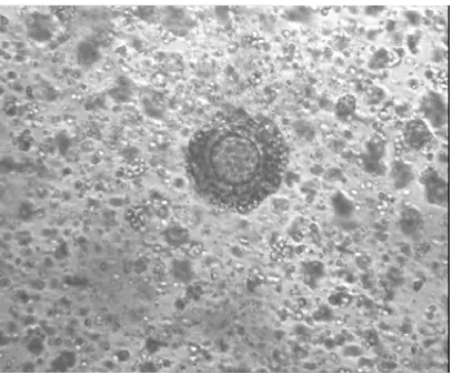 Figure 6. intra cytoplasmic sperm injection