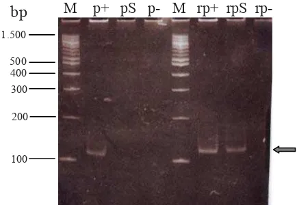 Figure 3. Conﬁ rmation of RNA transcription result by PCR and RT-PCR. Line M: DNA ladder