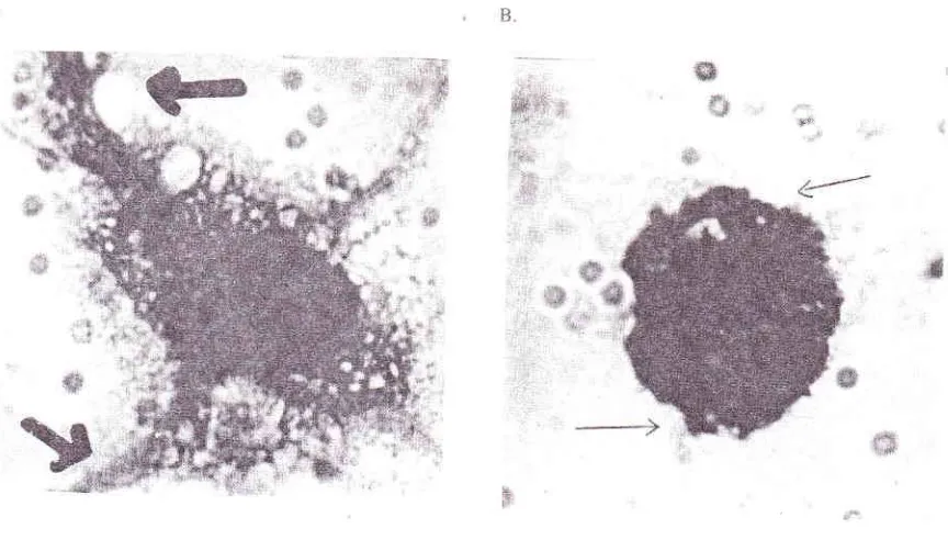 Figure l' A B' Tlte length of pseudopodia (the arrow) before [reatment witl.r bisindolylmaleimides after 30 minutes of observation (200X)The length of pseudopodia (the arrow) before treatment with bisindolylnnleimi'des after 30 n i,tut"s oj obrn*otk , ( I000X).