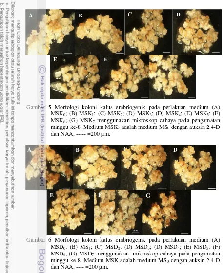 Gambar 5 Morfologi koloni kalus embriogenik pada perlakuan medium (A) 