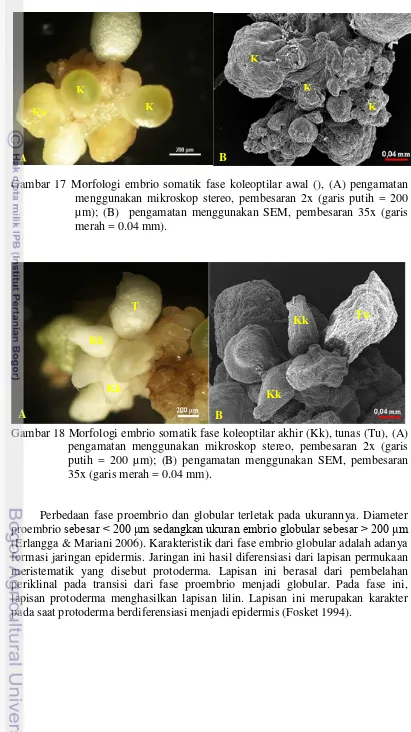Gambar 18 Morfologi embrio somatik fase koleoptilar akhir (Kk), tunas (Tu), (A) pengamatan menggunakan mikroskop stereo, pembesaran 2x (garis putih = 200 µm); (B) pengamatan menggunakan SEM, pembesaran 35x (garis merah = 0.04 mm)