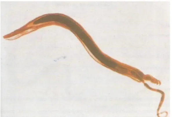 Gambar 2.10. Schistosoma japonicum Dewasa 226