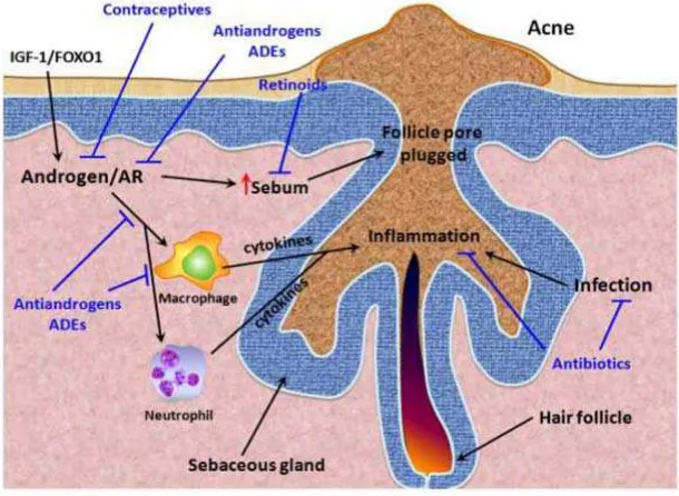 Gambar 2.5. Faktor Hormonal terhadap Terjadinya Acne 
