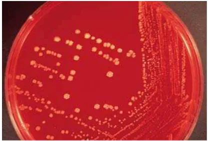 Gambar 2.1. Kultur Staphlococcus aureus dengan warna koloni 