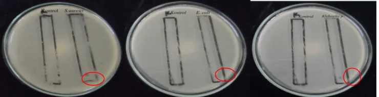 Gambar 5. Hasil Bioautografi ekstrak etanol kulit batang tumbuhan Sala terhadap S.aureus(A), Escherichia totolan yaitu zona radikal