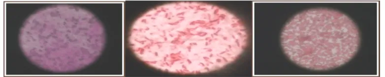 Gambar 1. Hasil pengecatan Gram bakteri Staphylococcus ureus berwarna ungu (A), Escherichia coli (B) dan Klebsiella pneumonia (C) berbentuk batang, menyebar dan berwarna merah