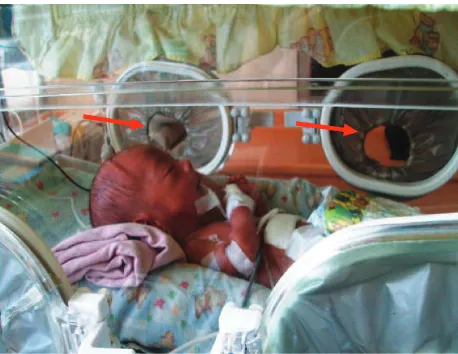 Figure 2. Incubator’s attached gloves (red arrow)