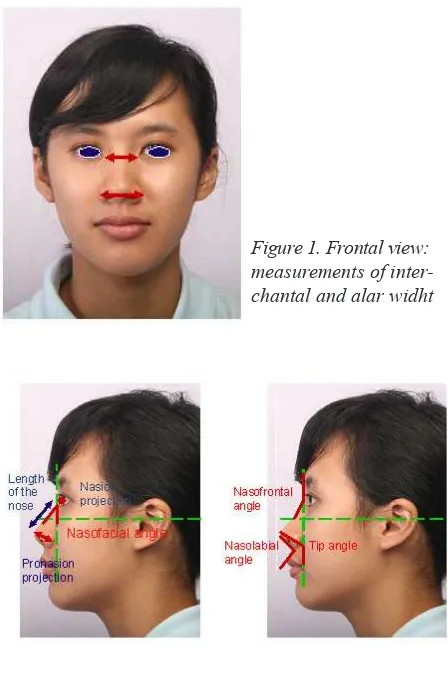 Figure 1. Frontal view: 