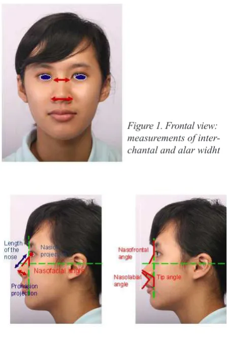 Figure 1. Frontal view: 