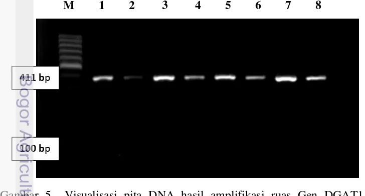 Gambar 5  Visualisasi pita DNA hasil amplifikasi ruas Gen DGAT1 pada gel                