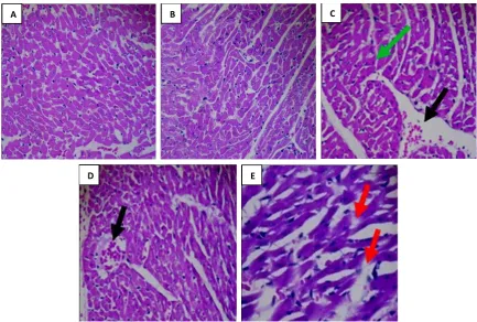 Figure 2. Histology of anaerobic groups; A, control (normal); B, day 1 (normal); C, day 3 (hypertrophic, the arrows denote cardiac muscle cells looking larger and the ibers of cardiac muscle showing disarray); D, day 7 (isch-emic, the arrows denote mitochondria appearing dark, sarcolemma damaged, chromatin nuclei condensed and on the edge, erythrocytes trapped in the capillaries); E, day 10 (infarcted, the arrows denote damaged heart muscle ibers, which underwent stretching, looking wavy, seen rarely, and tearing occured)      