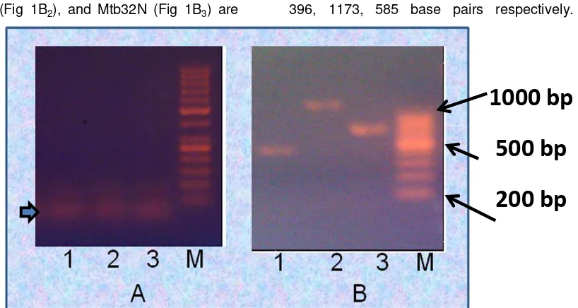 Fig 1. Agarose gel images showing the effects of DMSO during amplification (B) and control (no DMSO, B)