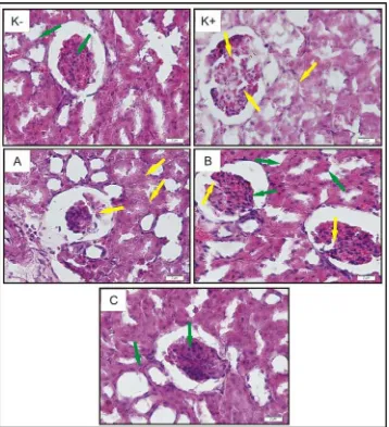Figure 2. Histology of the rat’s kidney magnified 600 times (Control mice (K-), diabetic mice (K+), therapeutic mice treated with doses of D-alpha-tocopherol 100 mg/kg BW (A), 200 mg/kg BW (B), and 300 mg/kg BW (C)