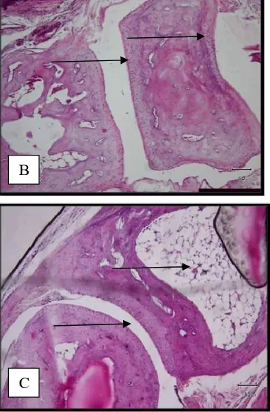 Figure 2. Arrows indicate the occurrence of structural changes in hyaline cartilage (cartilage) on HE staining results on Rheumatoid Arthritis Foot (A= Leg joints of control rats (healthy); B= rats foot joint suffering rheumatoid arthritis; and C= foot joi