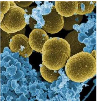 Gambar 10. Bakteri Staphylococcus aureus(http://millicent.blogdetik.com/2010/06/04/keyboard-sumber-bakteri)