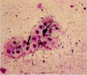 Gambar 1. Sitologi vagina pada pengamatan hari ke-1 kelompok injeksi diestrus awal ditandai dengan sel epitel parabasal (panah hitam) perbesaran 200x 