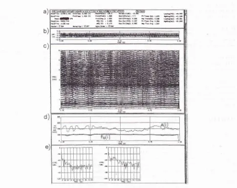 Figure 1. and The acoustic feature of avoice sample analyzedby "SONG" computer-aided program