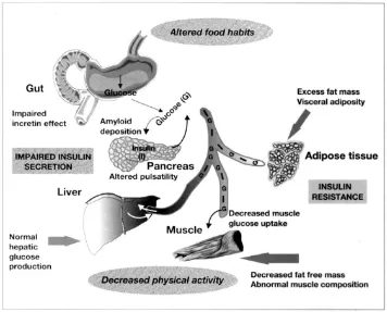 Gambar 2.1 Ilustrasi dari abnormalitas yang mempengaruhi sekresi insulin dan 
