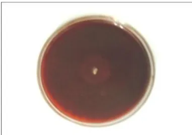 Gambar 1.Actinomycetes ANL-4 yang mempunyai kemampuan dalam mendegradasi kitin pada  media mineral-salt agar plate dengan Kitin 1% dengan pewarnaan Congo Red 1 % 