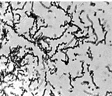 Gambar 2. Isolat actinomycetes secara mikroskopik  Isolat  actinomycetes  yang  akan 