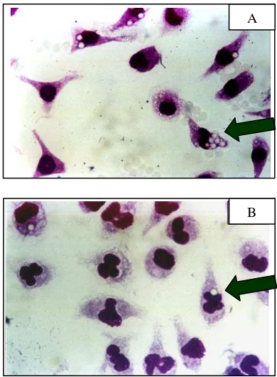 Figure 4. Average number of latex phagocytosed by 100 peritoneal macrophages of the Balb/C mice during S