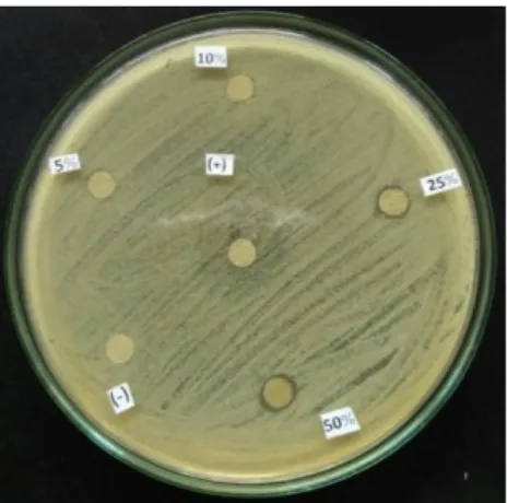 Gambar 2. Hasil pengamatan DZI uji  antimikroba (pembanding tetrasiklin)  Keterangan: (+) tetrasiklin, (-) DMSO 