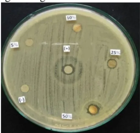 Gambar 3. Hasil pengamatan DZI uji  antimikroba  (pembanding  ciprofloksasin) 