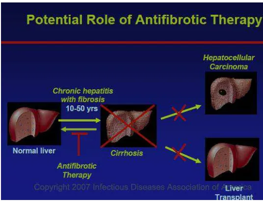 Gambar 10;   Tujuan terapi anti fibrotic  20 