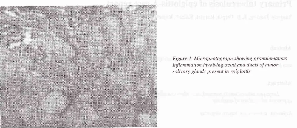 Figure 1. Microphotograph showing granulamalous