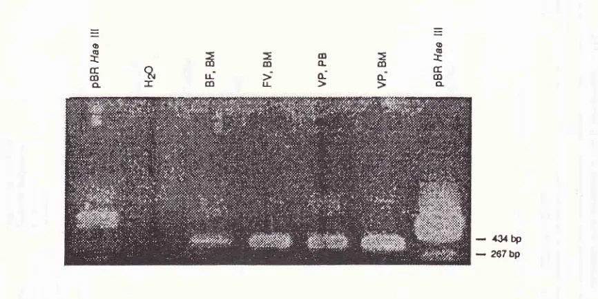 Figure (Iane I and gene used pBR Hae 4. PCR III analysis of the Vô2-D63 rearrangenrents in j ALL patients (lane 3-6)