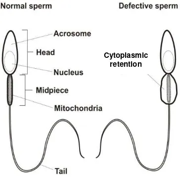 Figure 2.  Schematic representation of a normal mature spermatozoon (left), and a defective spermatozoon showing cytoplasmic retention in the mid-piece 