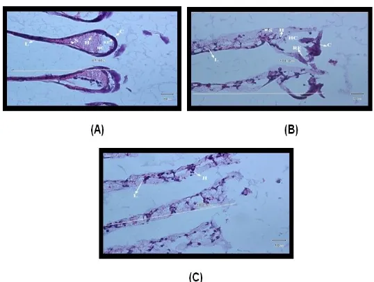 Gambar 2.  Lamela insang yang menunjukkan lesi epitel dan infiltrasi hemosit pada masing-masing perlakuan konsentrasi sublethal fenol (H: hemocyte; HC: haemocoel; L: lamella; C: cuticule) 