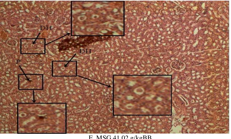 Gambar 4.1 Pengamatan Histopatologi jaringan ginjal            