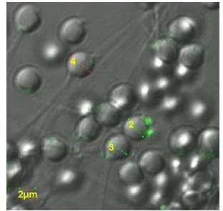Figure 1.  Fluorescence and interaction of hr GFP in Carp Fish sperm 